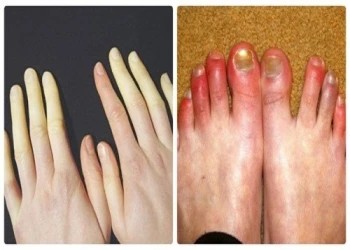 Miền Bắc chuyển lạnh sâu đột ngột, đề phòng cước chân tay xảy ra